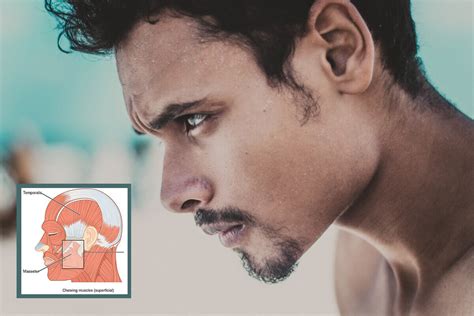 pulled jaw muscle