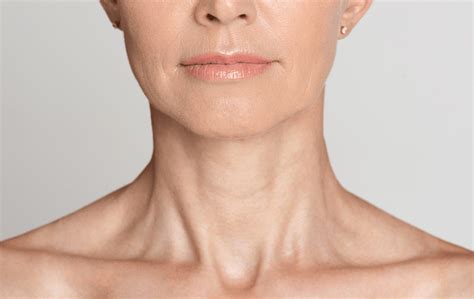 Turkey Neck | Causes & Treatments | Aesthetics Life