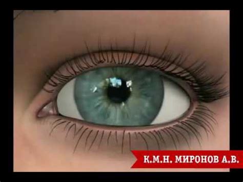 Астигматизм - что это? Причины и виды астигматизма глаза. - YouTube