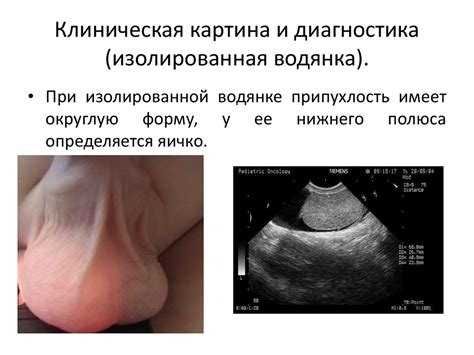 Патология вагинального отростка брюшины - презентация онлайн