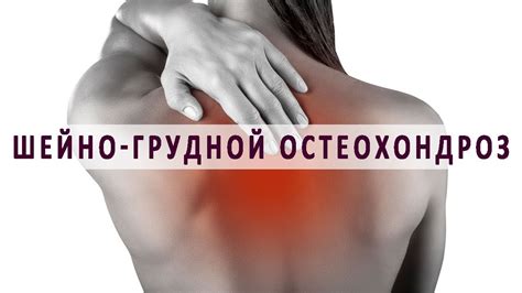 Остеохондроз шейно-грудного отдела позвоночника - YouTube