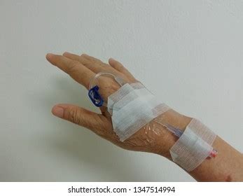 Method Intravenousiv Saline Lock Insertion Giving Stock Photo ...