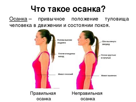 Нарушение осанки, виды, причины, профилактика нарушения