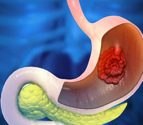 citizens speciality hospital duodenum