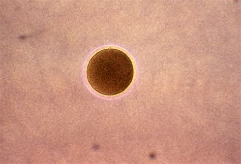 Foto gratis: microfotografia, colonia, Neisseria, gonorrhoeae