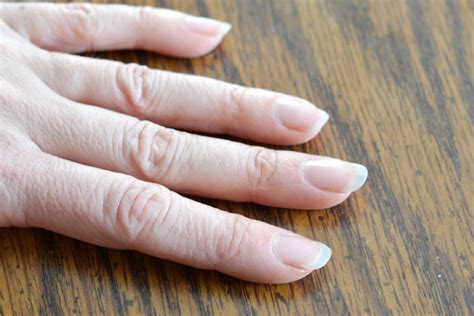 How To Take Care of Painful Dry Cuticles? | Hergamut.in
