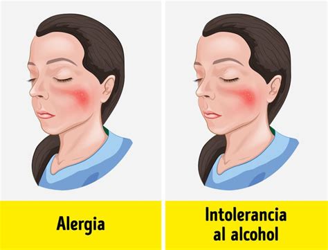 Intolerancia A Álcool - 9 Síntomas de intolerancia al alcohol que podrían ignorarse o ...