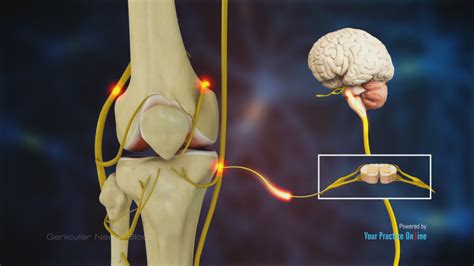 Genicular Nerve Block and Radio Frequency Neurotomy of Knee Joint ...