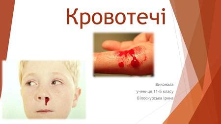 Презентация на тему: "ВИДИ КРОВОТЕЧ. ПЕРША МЕДИЧНА ДОПОМОГА ПРИ ...