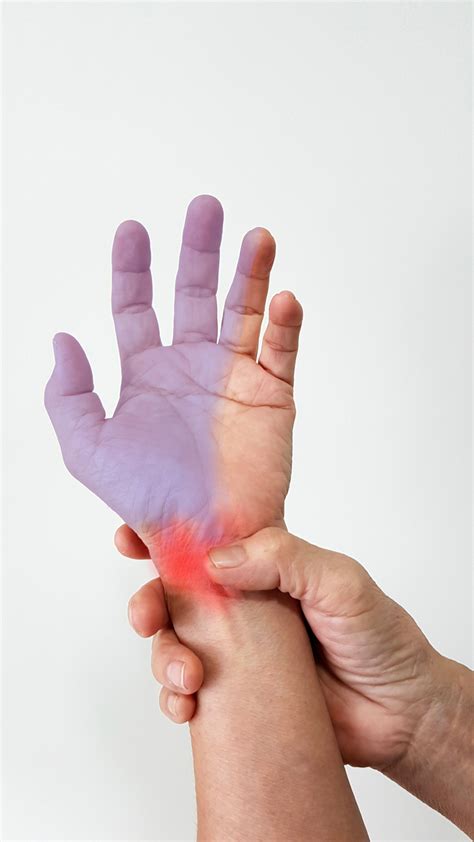 Carpal Tunnel Syndrome - Amara Pain & Spine Management