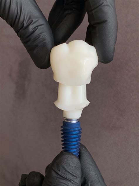 Implantology | Ortho Implant Center