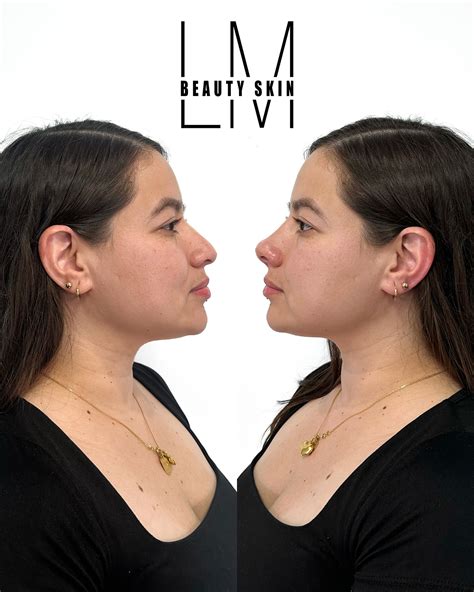 Beauty Skin By: Liliana Moreno (@lm_beauty_skin) • Instagram photos and