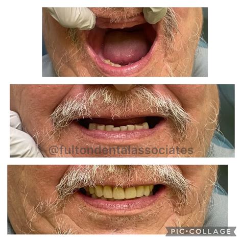 Fulton Dental Associates | Houston TX