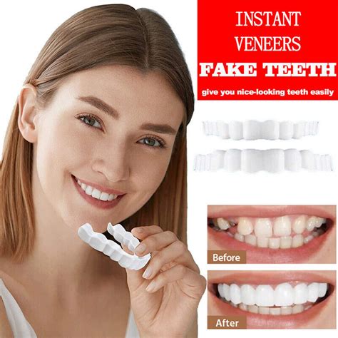 smile snap  upperbottom set false teeth denture veneers dental tooth