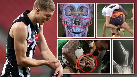 The worst AFL and NRL injuries in 2020 | The Courier Mail