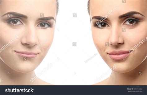 Woman Face Before After Cosmetic Procedure Stock Photo 491814466 ...