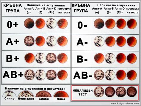 КРЪВ, БЕЗ КОЯТО НЕ МОЖЕМ – КАКВО ТРЯБВА ДА ЗНАЕМ ЗА КРЪВНИТЕ ГРУПИ ...