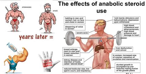 The Side Effects of using Anabolic Steroids - HEALTH & GYM GUIDE