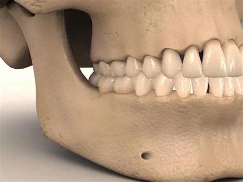 3D Model: Human Skull with teeth ~ Buy Now #91482307 | Pond5