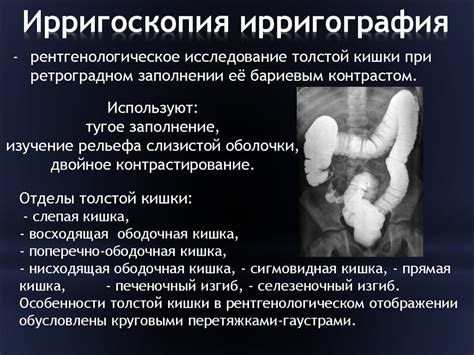 Лучевая диагностика заболеваний желудочно-кишечного тракта ...