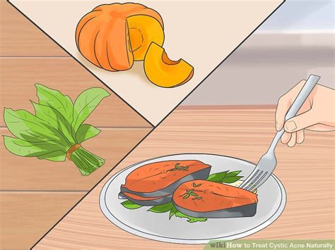 how to treat cystic acne at home