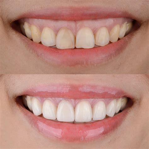 Winston-Salem Dental Specialists can help you achieve the smile of your