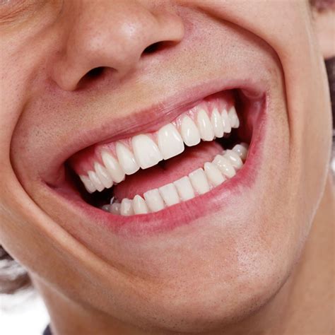 ᐉ Конец за Зъби • Как се използва | Medical Dent