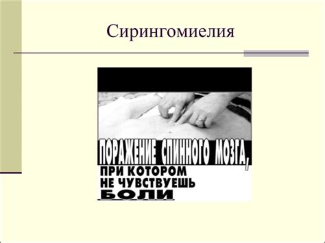 Сирингомиелия. Этиология и патогенез - презентация онлайн