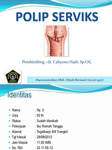 Polip Serviks_14 September 2012