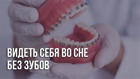 Видеть себя во сне без зубов: сонник для женщин и мужчин
