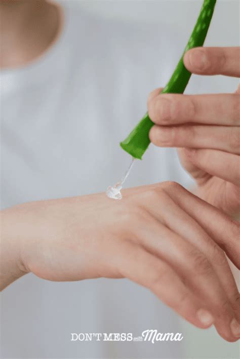 Aloe Vera for Acne Scars + 2 DIY Aloe Vera Acne Remedies - Don’t Mess ...