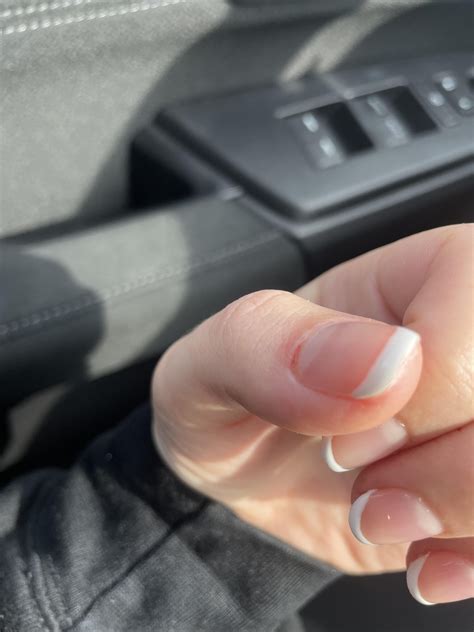 Will my proximal nail fold reattach? Salon drilled it off : r