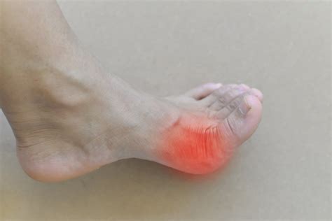 TenJet For Tendon Injury — Foot Doctor NJ
