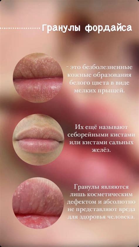 Перманентный макияж | Ботокс губы, Инъекции губ, Перманентный макияж
