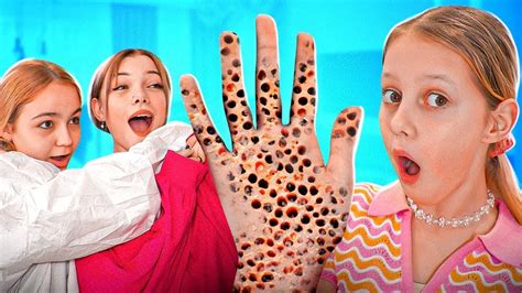 Амелка има тешку болест! | Ко ће помоћи и спасити Амелку? - YouTube