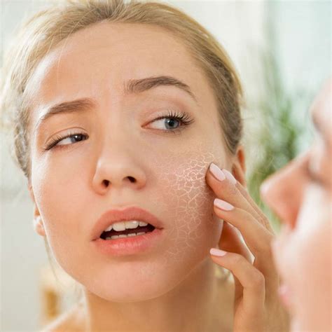 Dry Skin Type • Treatments & Skincare • NASCENT Skin Clinic