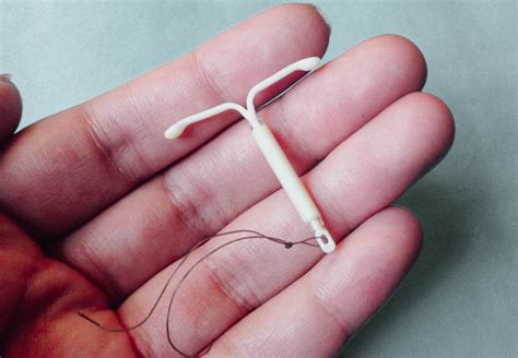 mirena intra uterine device iud insertion  removal collingwood