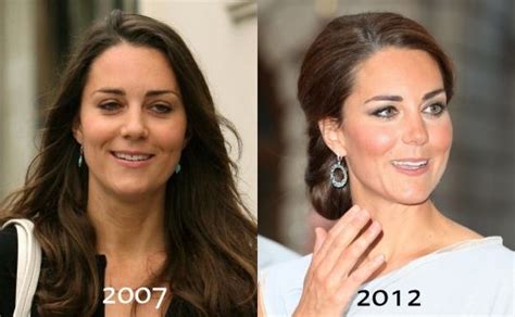 Kate Middleton Nose Shape