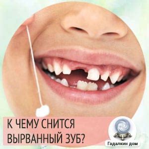 К чему снится вырванный зуб