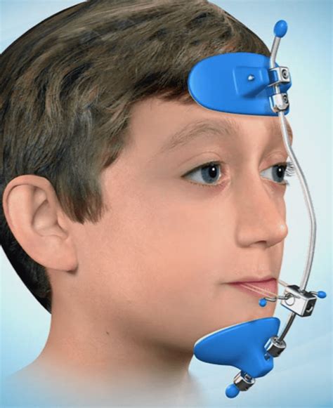 braceline orthodontics  drsuhas services