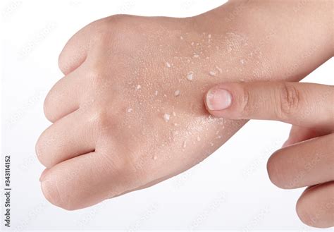 I rubbed the back of my hand to get dead skin cells. Stock Photo ...