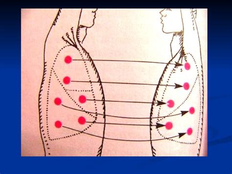 Аускультация легких. Метод аускультации - презентация онлайн