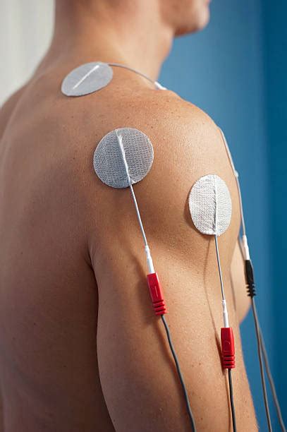 TENS Unit | Saskatoon Chiropractor, Physiotherapy, Acupuncture, Massage