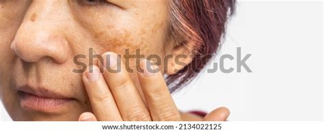 Menopause Affect Skin: Over 12 Royalty-Free Licensable Stock Photos | Shutterstock