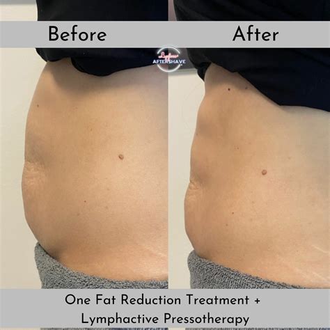 Sammy Ts: Before & After Results That Will Shock You! Image 1