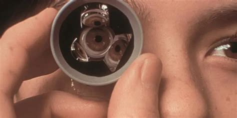 gonioscopy american academy  ophthalmology