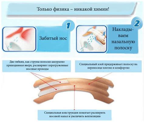 Аналоги пластыря Сопелка
