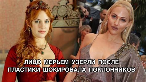 ЛИЦО МЕРЬЕМ УЗЕРЛИ ПОСЛЕ ПЛАСТИКИ ШОКИРОВАЛО ПОКЛОННИКОВ. Meryem Uzerli ...