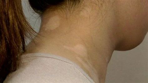 Kanebo apologises for lightening products' skin damage - BBC News
