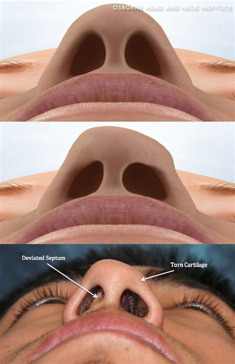 normal   nose  walton edwards blog